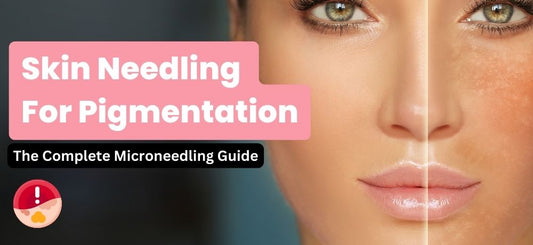 Skin Needling for pigmentation