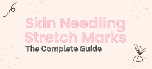 Skin Needling Stretch Marks: The Complete Microneedling Guide