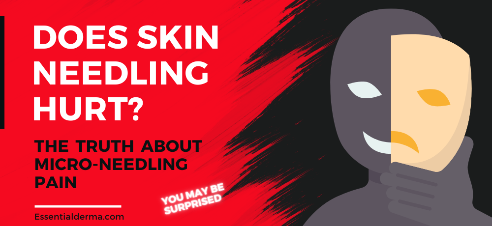 Does Skin Needling Hurt?
